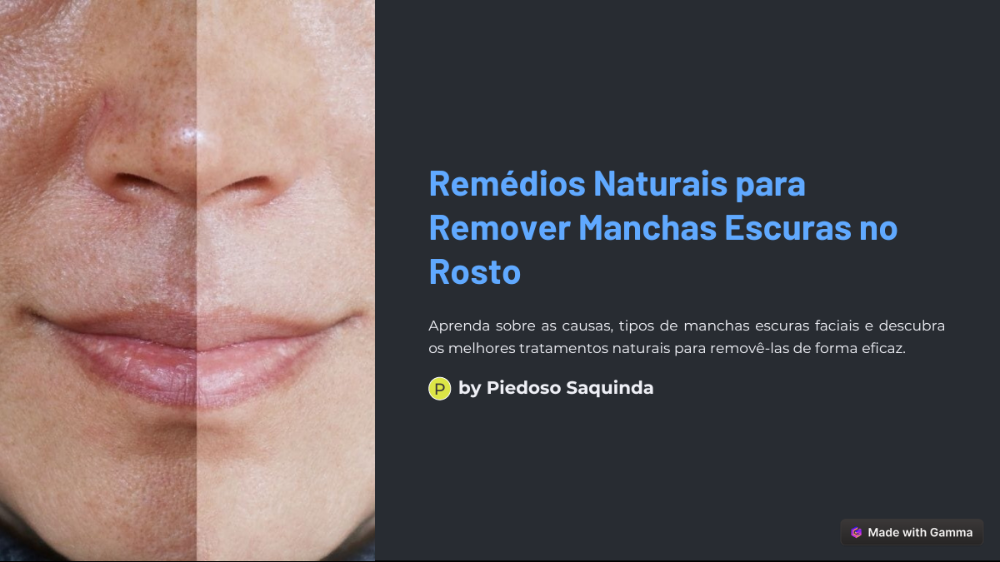 remedios_naturais_para_remover_manchas_escuras_no_rosto_1927
